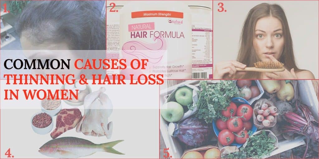 Common Causes of Thinning & Hair Loss in Women