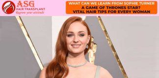 What Can We Learn from Sophie Turner- A Game of Thrones Star? Vital Hair Tips for every woman