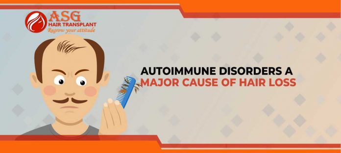 Autoimmune Disorders a Major Cause of Hair Loss