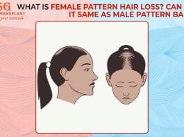 What is female pattern hair loss?