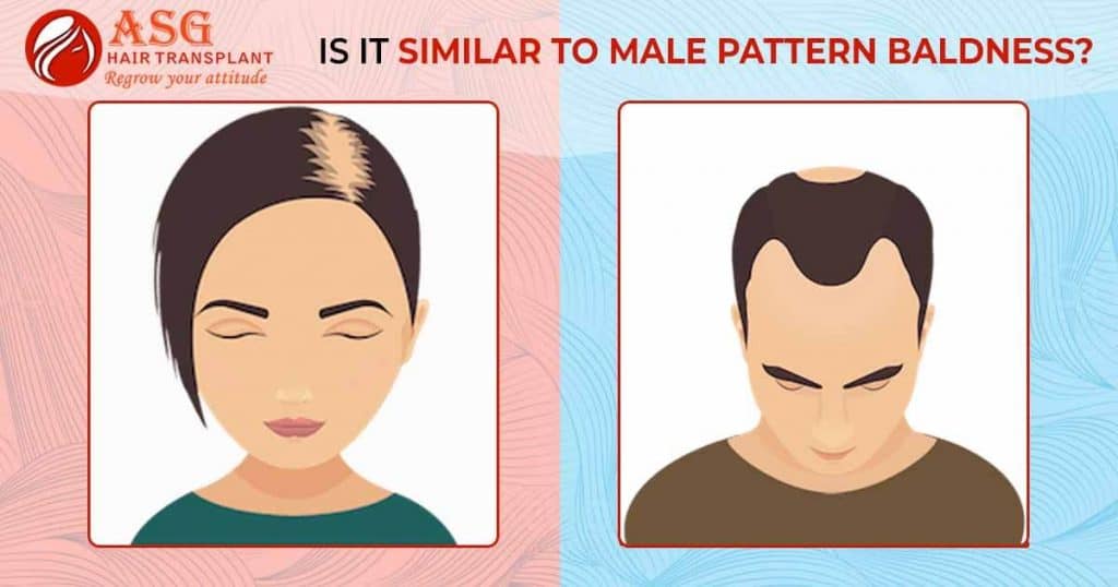Is it similar to male pattern baldness?