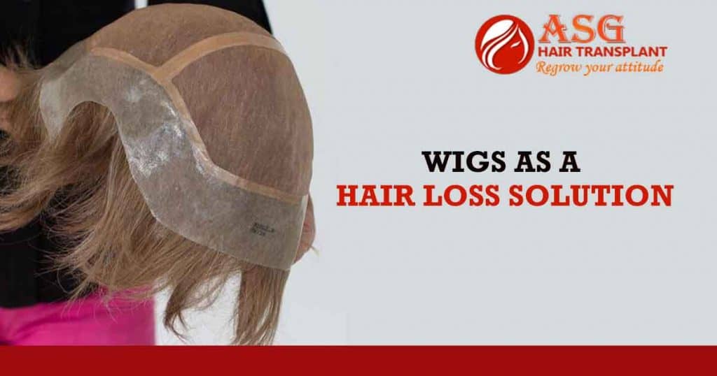 Wigs As A Hair Loss Solution