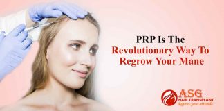 PRP Is The Revolutionary Way To Regrow Your Mane