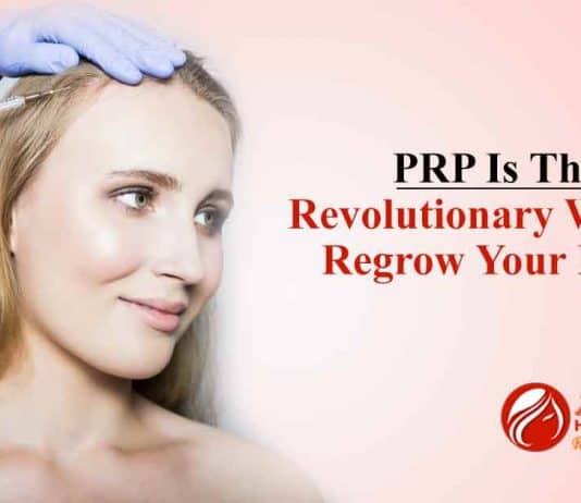 PRP Is The Revolutionary Way To Regrow Your Mane