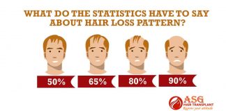 What do the statistics have to say about hair loss pattern?