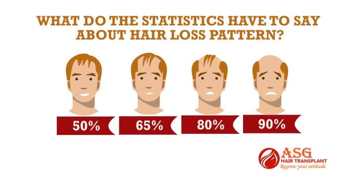 What do the statistics have to say about hair loss pattern?
