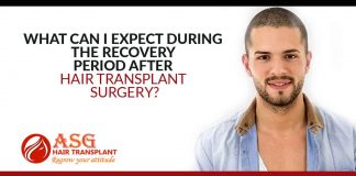 What Can I Expect During The Recovery Period After Hair Transplant Surgery?
