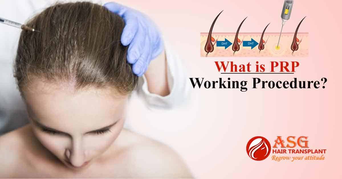 What is PRP working procedure?