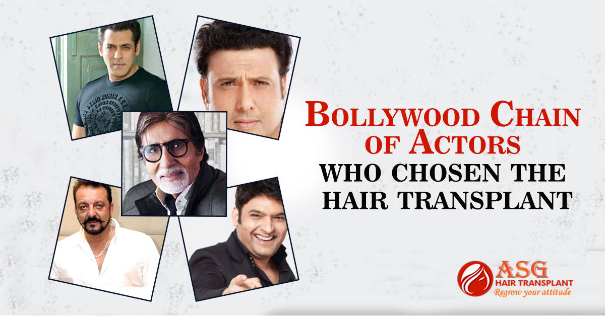 Bollywood Chain Of Actors Who Chose Hair Transplant.