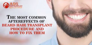 The most common aftereffects of beard hair transplant procedure and how to fix them