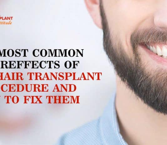 The most common aftereffects of beard hair transplant procedure and how to fix them