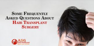 Some Frequently Asked Questions About Hair Transplant Surgery