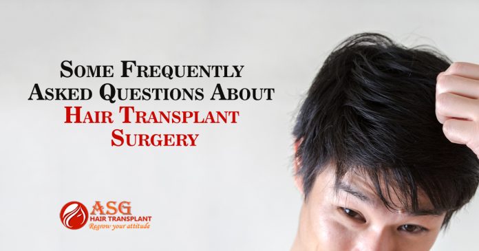 Some Frequently Asked Questions About Hair Transplant Surgery