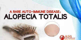 Auto Immune Disease