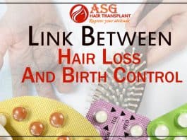 Link Between Hair Loss And Birth Control
