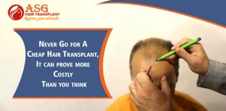 Never Go for A Cheap Hair Transplant, It can prove more Costly Than you think