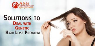Solutions to Deal with Genetic Hair Loss Problem