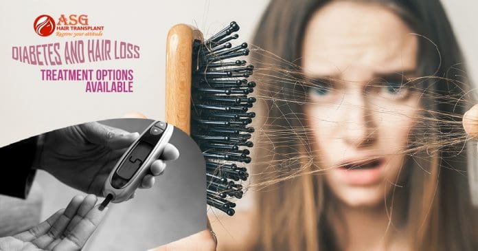 Diabetes And Hair Loss - Treatment options Available