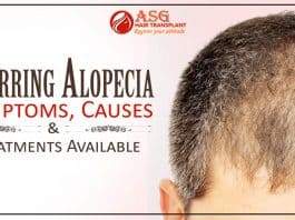 Scarring Alopecia - Symptoms, Causes And Treatments Available