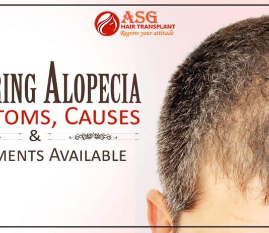Scarring Alopecia - Symptoms, Causes And Treatments Available