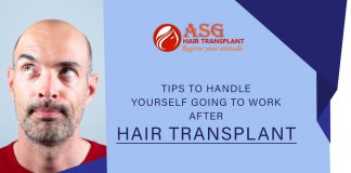 Tips to handle yourself going to work after hair transplant