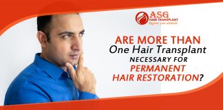 Are More than One Hair Transplant necessary for Permanent Hair Restoration?
