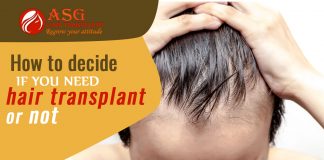 How to decide if you need hair transplant or not