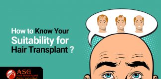 How to know your suitability for hair transplant