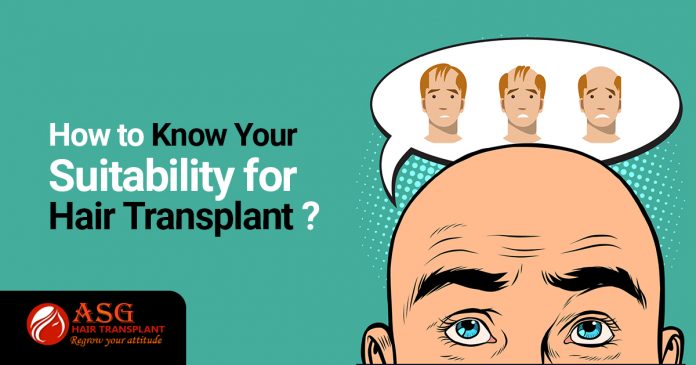 How to know your suitability for hair transplant