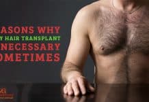 Reasons Why Body Hair Transplant is necessary sometimes