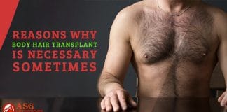 Reasons Why Body Hair Transplant is necessary sometimes