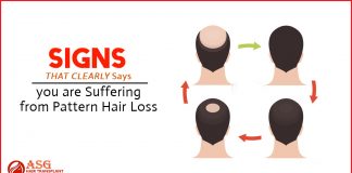 Signs That Clearly Says you are suffering from pattern hair loss