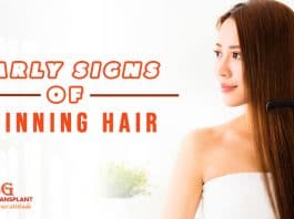 Early Signs of Thinning Hair