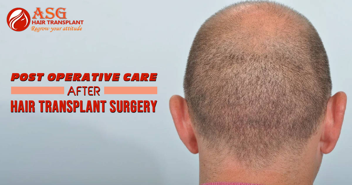 Post OP Care After Hair Transplant Surgery
