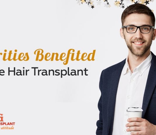 Celebrities benefited by the hair transplant