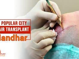 Most popular city for hair transplant Jalandhar