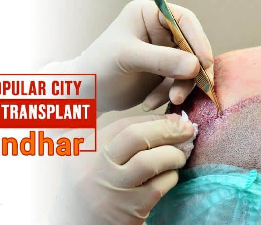 Most popular city for hair transplant Jalandhar