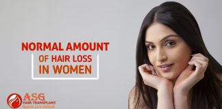 Normal Amount of Hair Loss in Women
