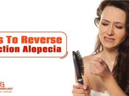 Tips To Reverse Traction Alopecia