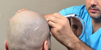 A New Approach to Treating Hair Loss