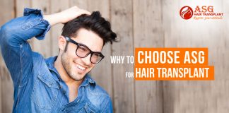 Why to Choose ASG for Hair Transplant Centre copy
