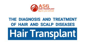 Hair transplants Is Hair Transplantation procedure leads to pain and discomfort