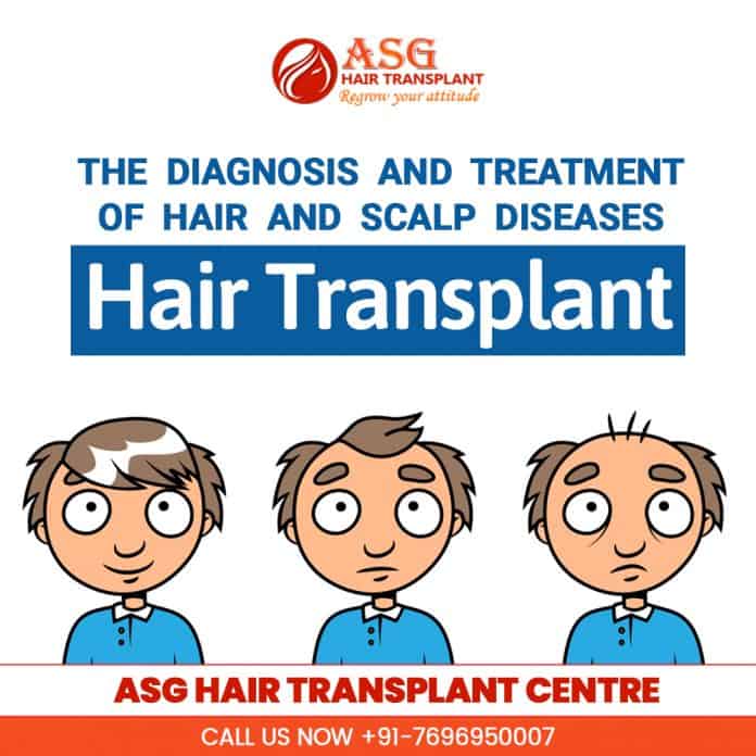 Hair transplants Is Hair Transplantation procedure leads to pain and discomfort