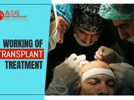 Working of hair transplant treatment