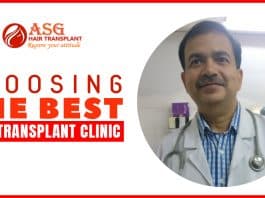 Choosing the Best Hair Transplant Clinic