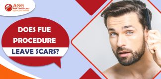 Does FUE procedure leave scars