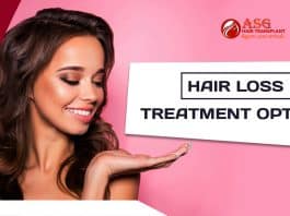Hair loss treatment options