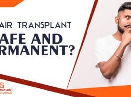 Is hair transplant safe and permanent - ASG Hair Transplant Centre Punjab
