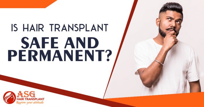 Is hair transplant safe and permanent - ASG Hair Transplant Centre Punjab