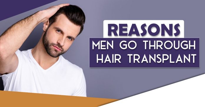 Reasons men go through Hair Transplant - ASG Hair Transplant Centre Punjab